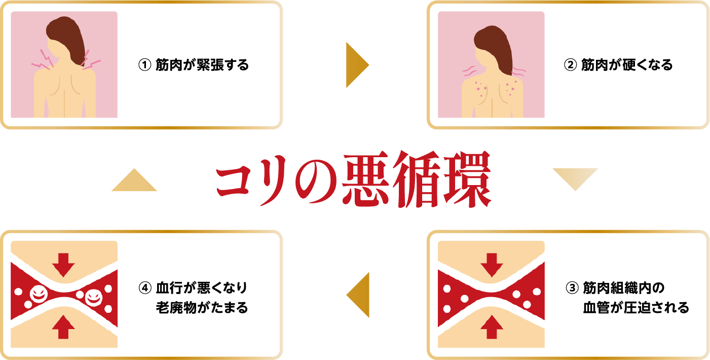 コリの悪循環 ①筋肉が緊張する ②筋肉が硬くなる ③筋肉組織内の血管が圧迫される ④血行が悪くなり老廃物がたまる